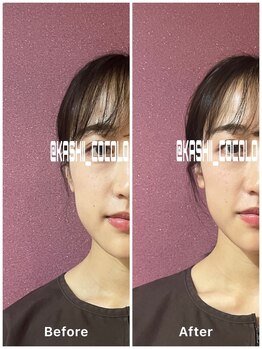 ココロ(CoCoLo)/ビフォーアフター