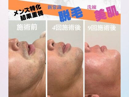 フォー(the 4)の写真