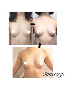 ラディス(Radice.)/ゆっくりバストアップ☆