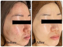 フルリールボーテ(Fleurir Beaut)の雰囲気（お客様のお肌状態に合わせてご提案させていただきます。）