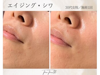 スリースリー(THREE THREE)/エイジング・しわケア