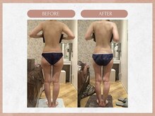 ソウイボディ 武蔵小杉店(Sou-i body)/お客様before→ after