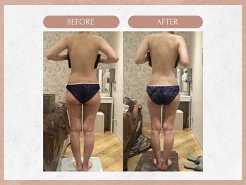 ソウイボディ 武蔵小杉店(Sou-i body)/お客様before→ after