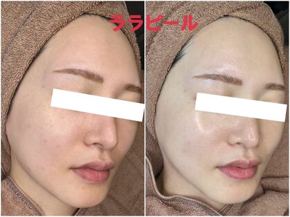 ちゅるん肌ドットコム 心斎橋店(ちゅるん肌.com)の写真