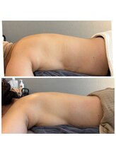 ミチカケ トリムリターン那覇市店/ペタんとしなやか背中に！