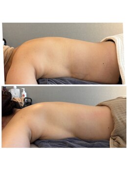 ミチカケ トリムリターン那覇市店/ペタんとしなやか背中に！