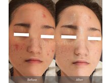 エングロー 錦糸町店(Englow)/