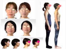 サマディの雰囲気（インスタ @masami.samadhi で多数症例掲載中！）