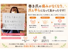 巻き爪矯正ラボ 水戸の雰囲気(巻き爪は親指以外にも起こります。親指以外も矯正可能です!)