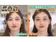 アイケアラボ(アイケアLaBo)の写真