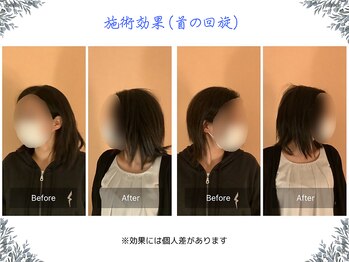 ボディ リセット アンド デザイン(Body Reset & Design)/【施術例】ビフォーアフター