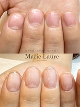 マリーロール 淀屋橋本店(Marie Laure)/自爪育成/深爪矯正/ネイルケア