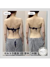 カラー(CALLA)/ブライダルにもおすすめ♪