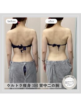 カラー(CALLA)/ブライダルにもおすすめ♪