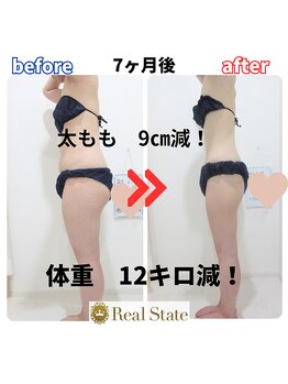 レアルステイト 御経塚店/セル脂肪/むくみ/美脚