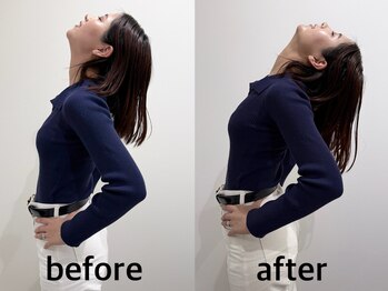巡 上野御徒町(MEGURU)/ビフォーアフター　上野肩こり