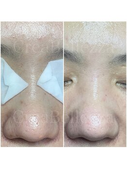 クレアベレッツァ(Crea Bellezza)/くすみがちな肌もトーンアップ♪