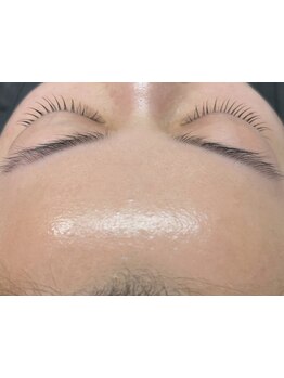 お肌をきれいにしたい