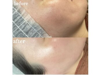 ブリリアント(brilliant)/フェイシャルワックス