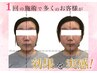 人気No,3【小顔矯正＋骨盤矯正】目元パッチリ&フェイスラインがシャープに♪