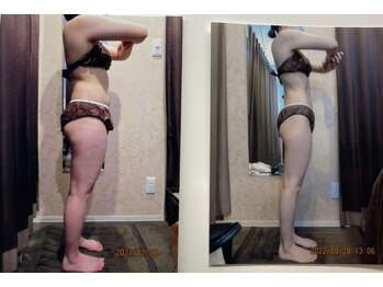 パーフェクトボディプレミアム 大阪梅田店(PERFECT BODY PREMIUM)/お客様　ビフォーアフター（1）