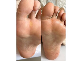 キラネイル アンド アイラッシュ by World Beauty(KIRA)/新潟フットケア