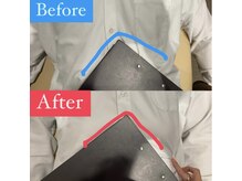 ナオル整体 宮崎院(NAORU整体)/30代男性施術事例【肋骨広がり】