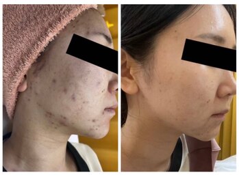 パールプラス 新倉敷店(Pearl plus)/BeforeAfter