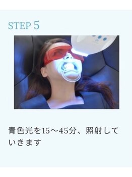 ホワイトニングショップ 新潟店/光を40分照射