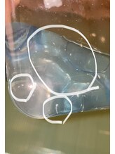 カランコエ(KALANCHOE)/毛穴洗浄後の結果