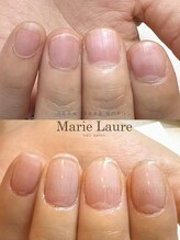 マリーロール 淀屋橋本店(Marie Laure)/自爪育成/深爪矯正/ネイルケア