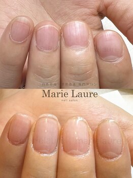 マリーロール 淀屋橋本店(Marie Laure)/自爪育成/深爪矯正/ネイルケア
