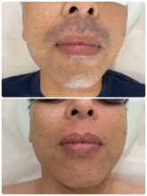 グランツ(GLANZ)/