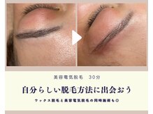 アール ピヴォワンヌ(R.pivoine)/電気脱毛●点で脱毛するイメージ