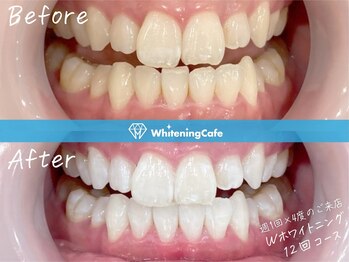 ホワイトニングカフェ 奈良新大宮店(WhiteningCafe)