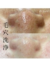 アース コアフュールボーテ 新潟紫竹山店(EARTH coiffure beaute)/毛穴洗浄