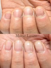 マリーロール 梅田店(Marie Laure)/深爪改善/自爪育成/ネイルケア