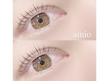 アミオ(amio)の写真