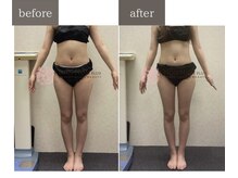 ノンノンプラス 博多(NON-NONプラス)/