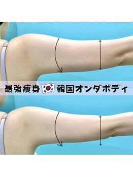 小顔専門カンナムビューティー 麻布十番店【ララピール/ハーブピーリング/小顔/痩身】/オンダリフト/麻布十番/六本木