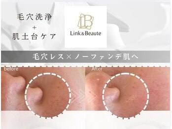 リンクアンドボーテ 大垣(Link&Beaute)の写真/【毛穴ケア人気No.1】黒ずみ・開き毛穴を徹底洗浄!つるんと毛穴レス肌へ