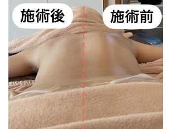 美バストアルファ(美bust α)/【バストアップ】背中もスッキリ