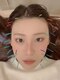 伊都整骨鍼灸院の写真/【小顔美容鍼！初回¥2,500】小顔矯正の効果はもちろん、ホウレイ線/たるみ改善/ニキビケアにもおすすめ◎