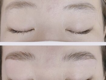 リアン/ハリウッドブロウリフト