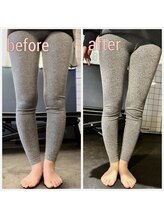 ビボディ(B-body)/o脚x脚　before→after