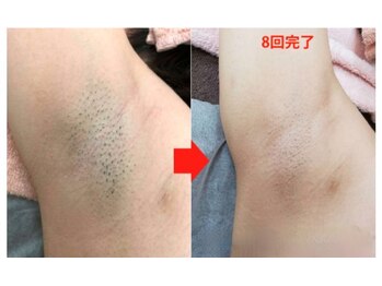 パールプラス 新倉敷店(Pearl plus)/BeforeAfter