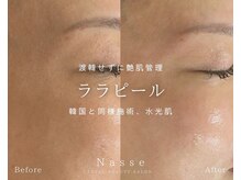 ナッセ(Nasse)