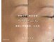 ナッセ(Nasse)の写真