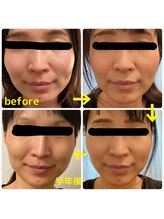 シエスタ(SIESTA)/ソフト小顔整体