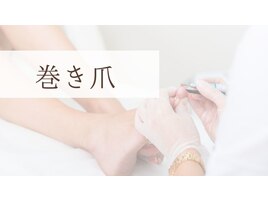 巻き爪